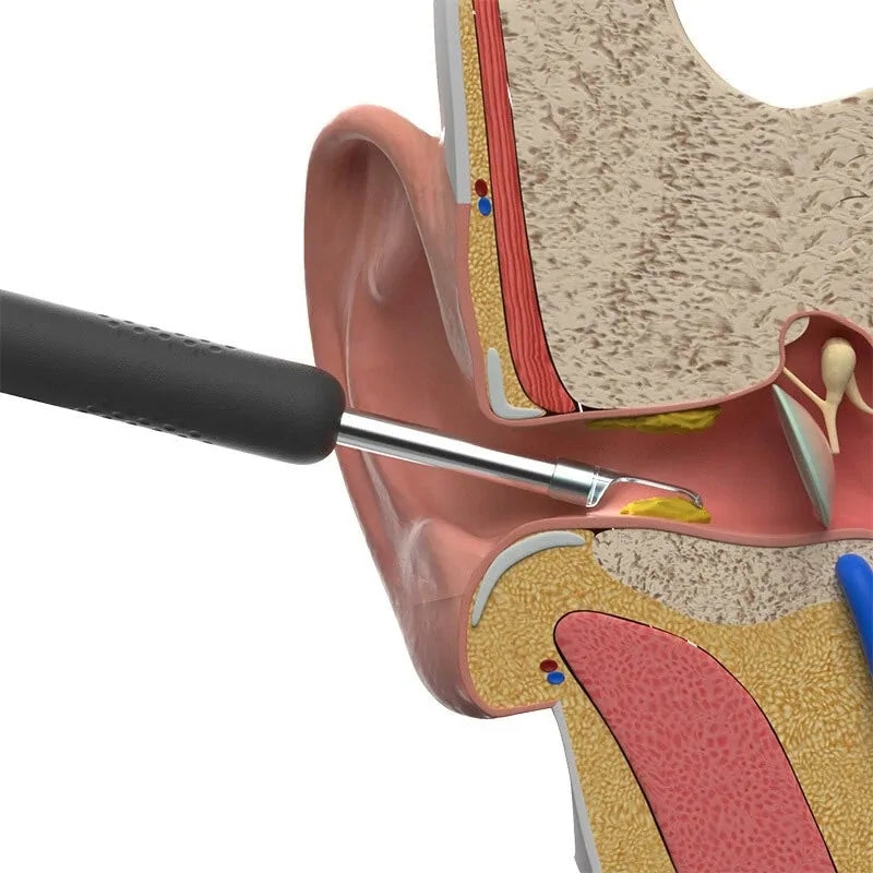 Hi-Tech Ear Cleaning Stick